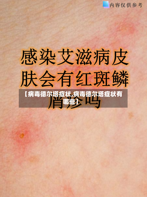 【病毒德尔塔症状,病毒德尔塔症状有哪些】-第2张图片