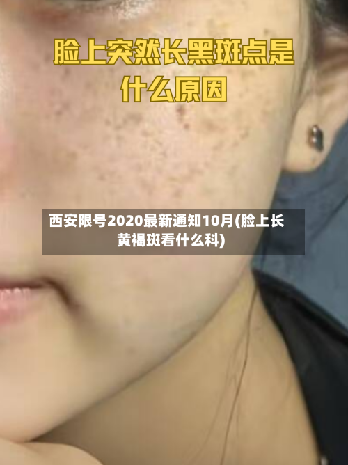 西安限号2020最新通知10月(脸上长黄褐斑看什么科)-第3张图片